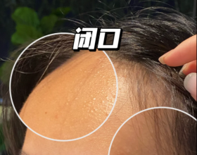 水杨酸棉片的正确使用方法，用对方法真的换脸
